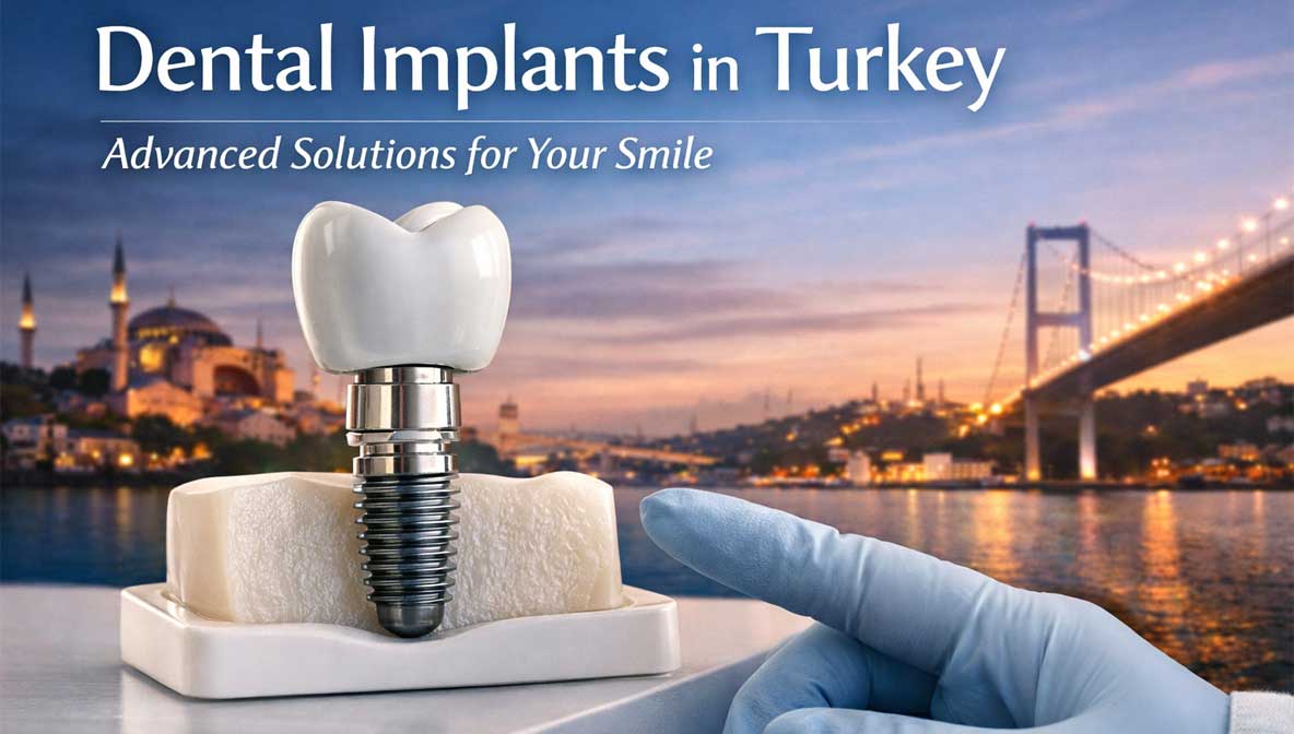 Dental implant model with a ceramic crown and titanium implant placed in bone, symbolizing advanced dental implant treatment in Turkey with Istanbul skyline in the background.